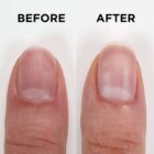 Nailtrition-BeforeAfter-096200013254