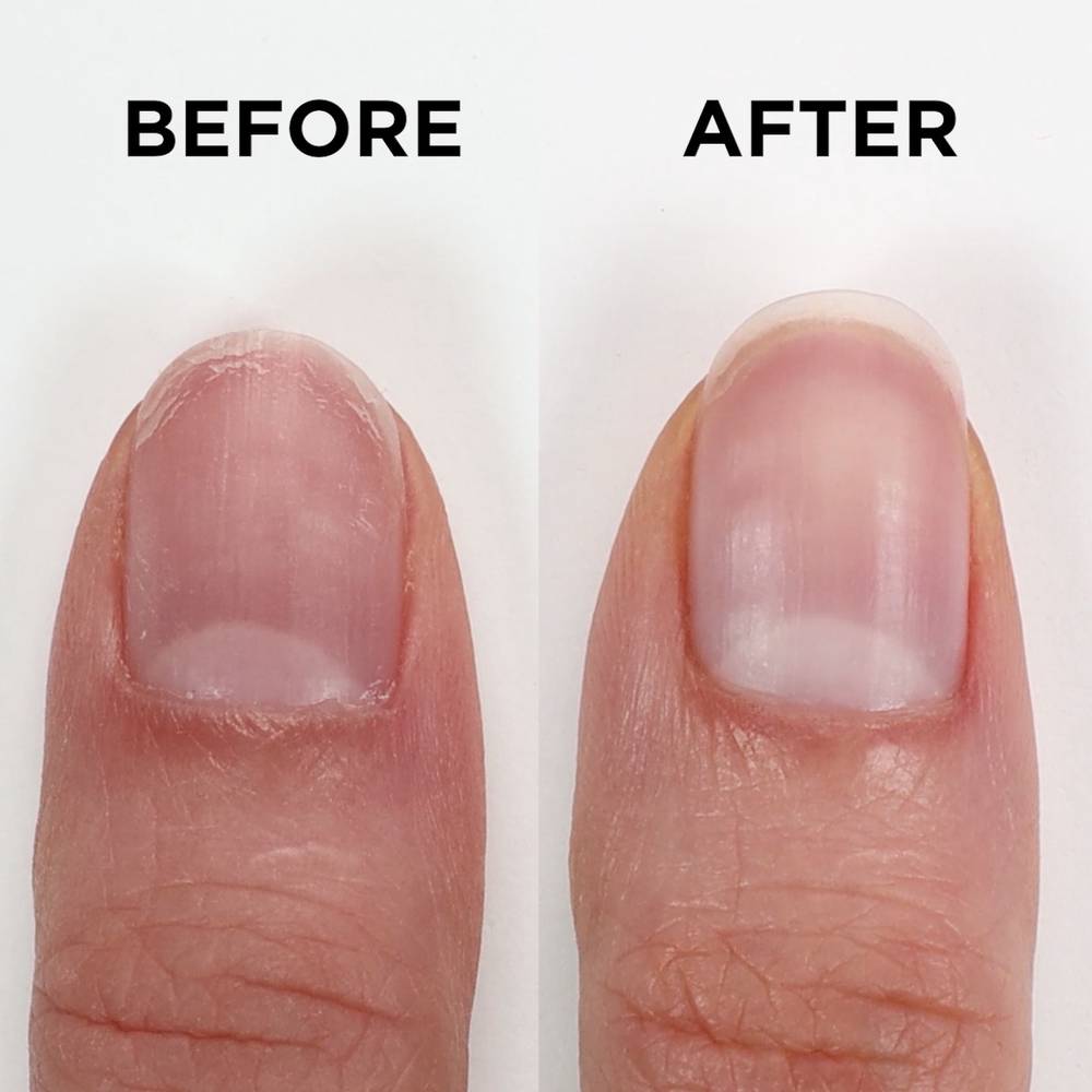 Nailtrition-BeforeAfter-096200013254 Nailtrition-BeforeAfter-096200013254